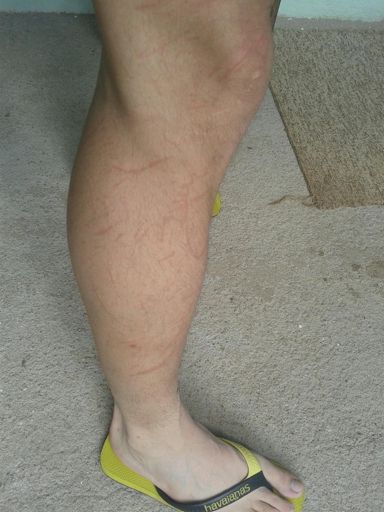 Pensa em um trem pra arderrrr