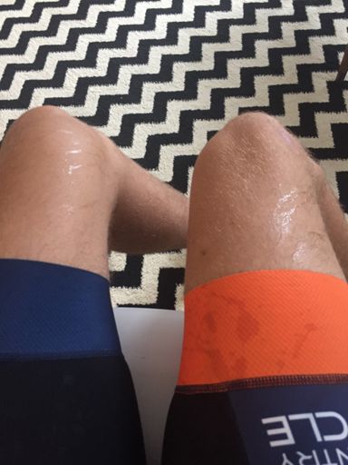 The liquid on my leg is liquid gel that upon receiving, I thought was going to be thicker/more syrup-like. This of course caused me to spill some on myself