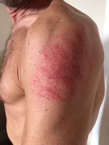 Was all going great until this happened 5 minutes from the finish