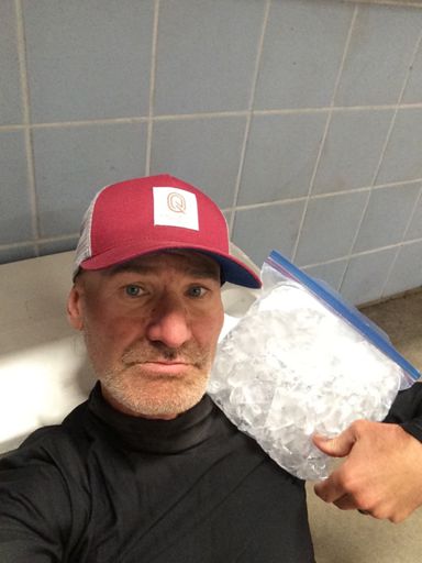 Jacked left shoulder