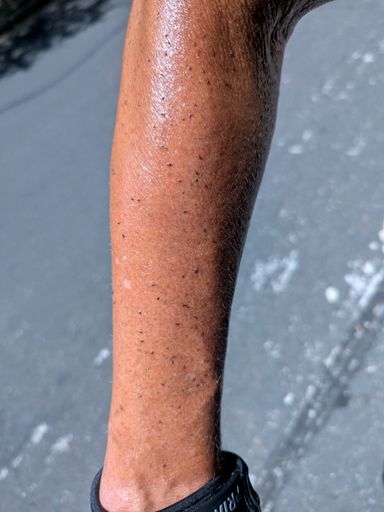 I can't even tell if it's dirt or bugs...