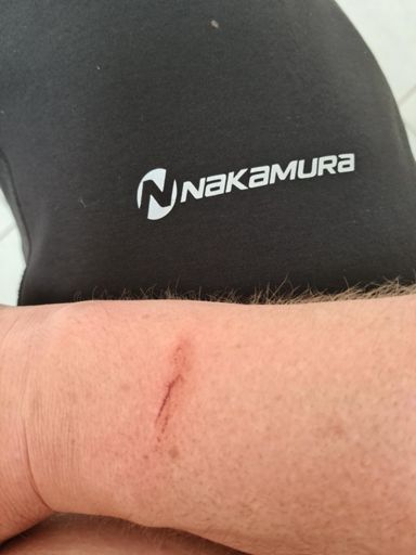 Ich...HASSE Brombeersträucher^^ 🤬🤬