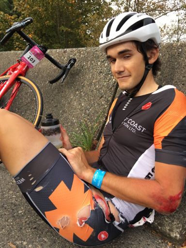 Faint at the sight of blood gang gang