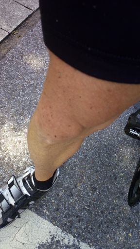 Einmal gesprenkelt. 😑