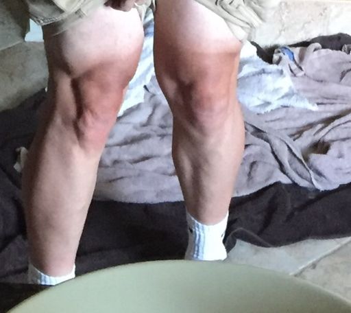 Skinny Vegan legs 😂