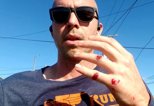 Picked a fight with a sidewalk in Stockyards this morning.