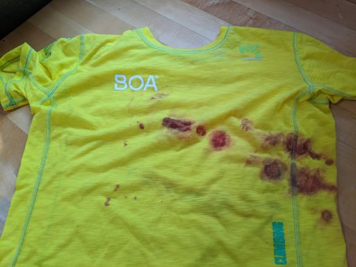 Had to tie this around my head to be able to keep running 🤕