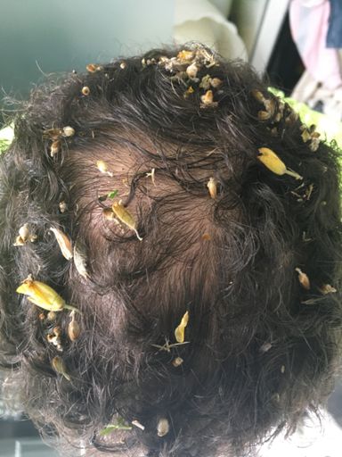 C’est même resté sous le casque 🤣 et en plus on dirai que je commence à me dégarnir merde alors 😢