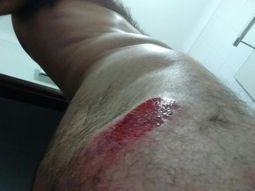 O estado em que ficou o cromado! E mais umas sarapintadelas aqui e ali! Nada de mais!