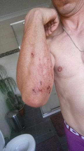 This from I hit the deck on the descent.