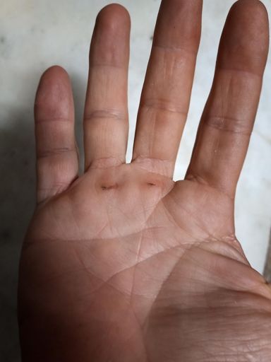 Hora de dejar descansar esas manos o buscar mejores guantes 😅🤦‍♂️.