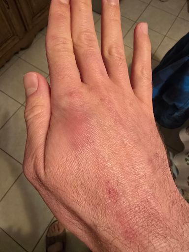 No pain no gain. P'tain de séparateur de ligne et de mauvais nageur qui font plus de vague sur le côté qu ils n avancent