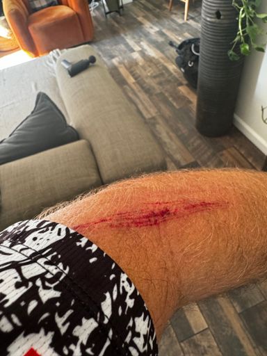 This is what koms get you