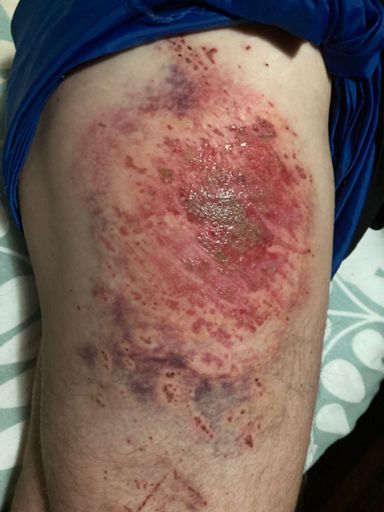 Op 85Km Val my swaer.