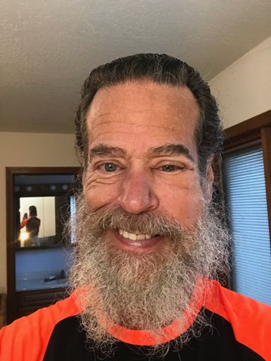 Tuesday morning, just prior to going to the dentist. Some of the swelling had already subsided.