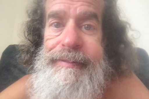 Some swelling after my ill-fated Monday run