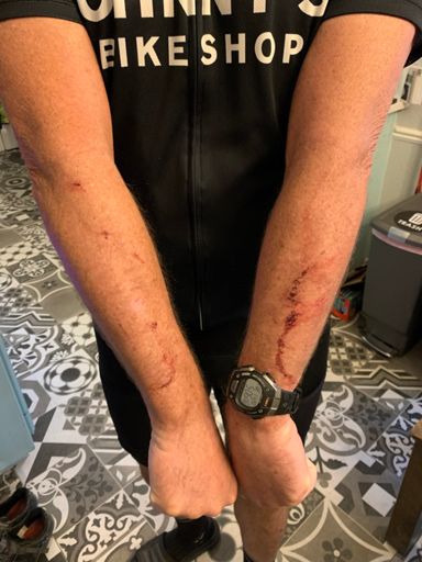 I always return from Thumper with battle scars 