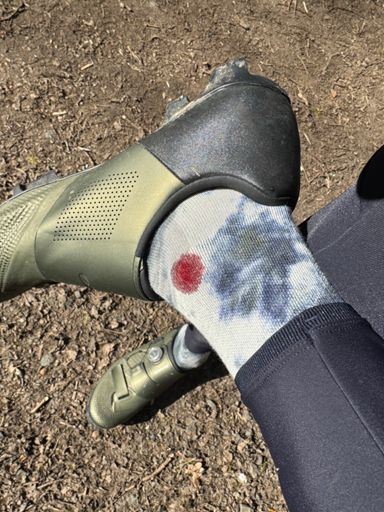 Classic pedal + ankle interaction 🤕 