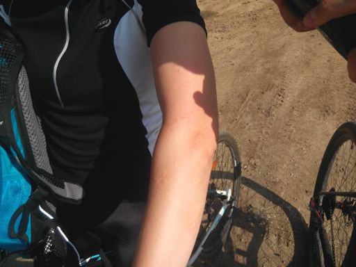 Упала в крапиву