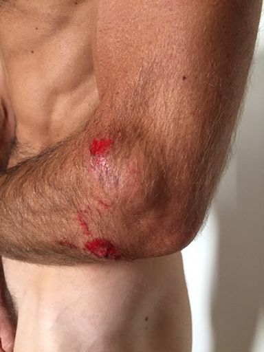 Was all going great until this happened 5 minutes from the finish