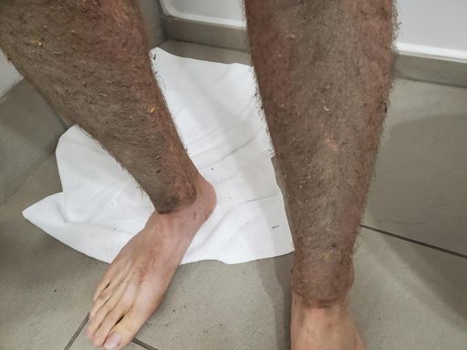 Post ride damage