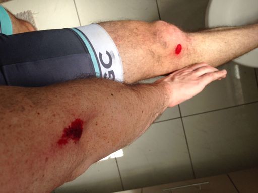 #skingrowsback At least it was a smooth bit of road!