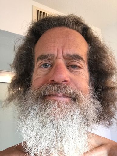 Wednesday morning, after my morning run, some swelling remains, but there's no discomfort.