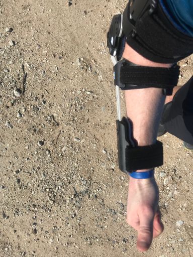 Stuck wearing this dumb brace makes me look like a robot.