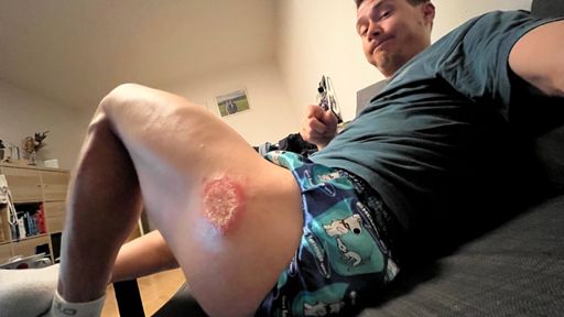 Hojí se to, ale vypadá to buď jak beďar o průměru deseti čísel, nebo takovej ten hlemýžď v moři nebo měsíční kráter. 😆😅