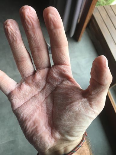 Pruney hands after riding in rain!