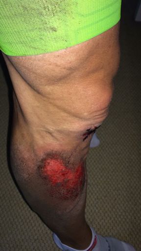 Radwege sind in Hamburg gefährlich