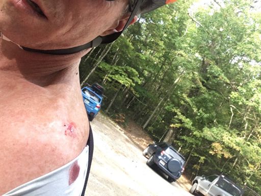 Hitting trees and eating  a bit of loose, dry dirt.  And yet, it was a fun ride.