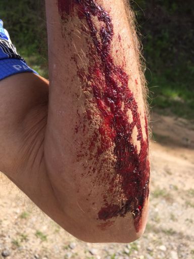 Gravel hurts at 30mph!!!