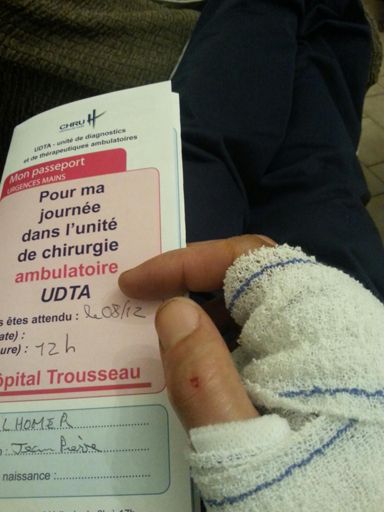 Gamelle, pouce cassé, demain pose de broches