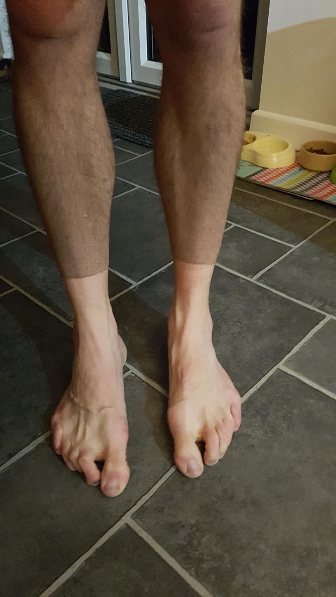 Don't look at my toes