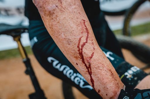 Always fighting a little bit with the 🌳here😅