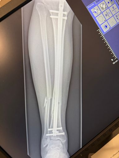 Gårdagens røntgenbilde