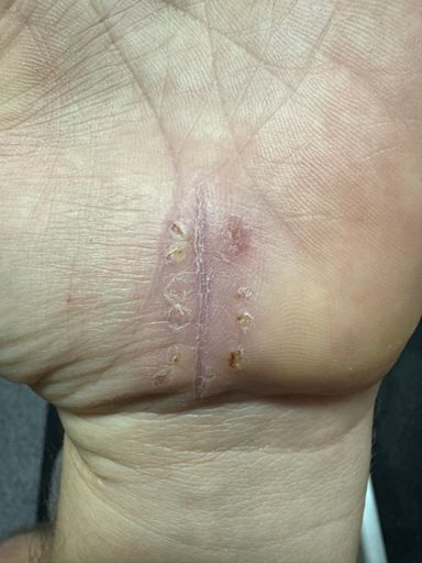 Looks gross but just dry and itchy as hell