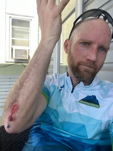 merely a flesh wound