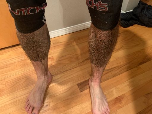 Guess they didn’t have fenders back then…